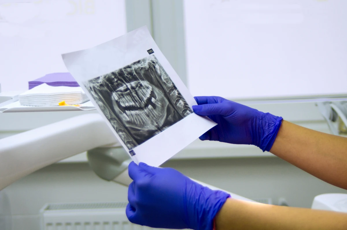 La synergie médico-sociale : un impératif légal pour une prise en charge optimale